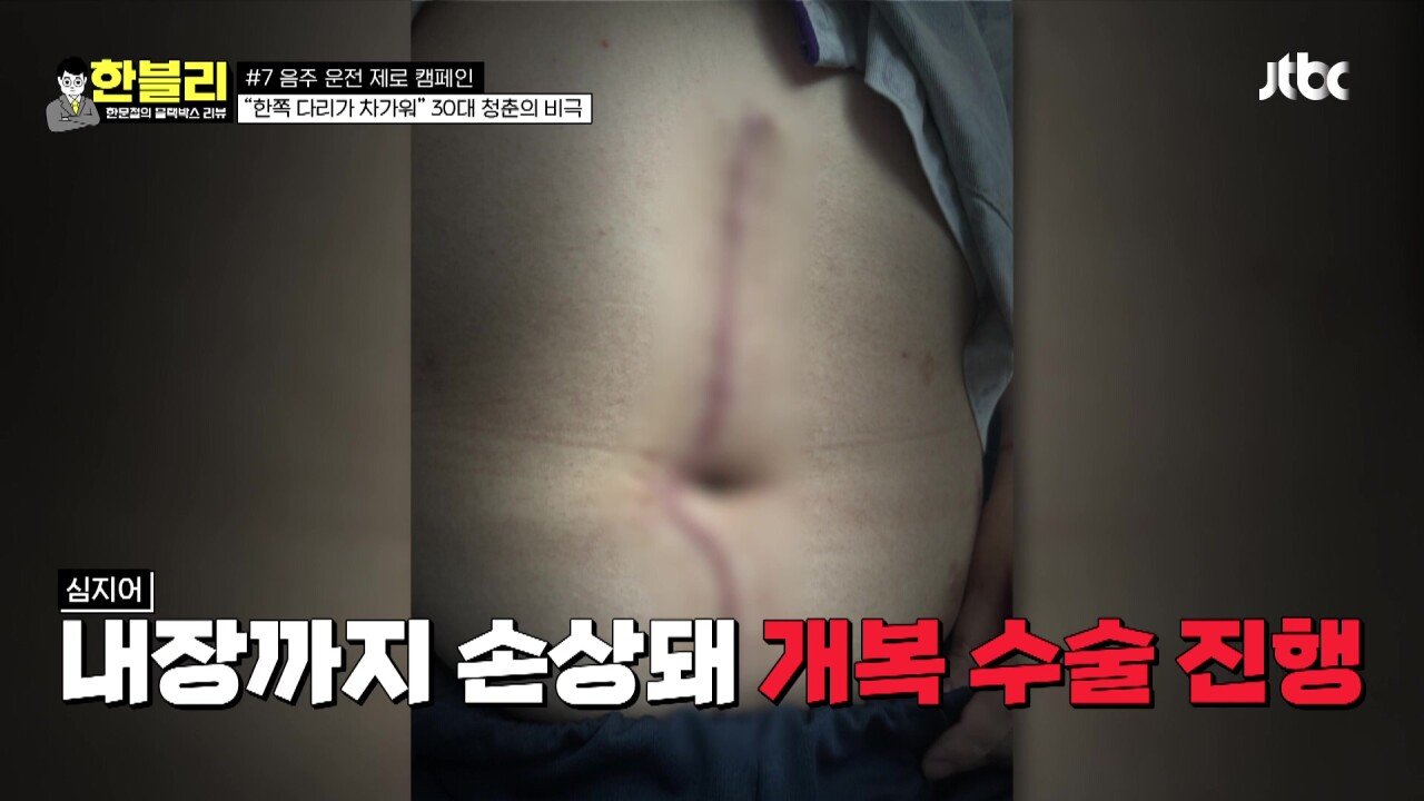 한블리 1.mp4_20230907_222237.869.jpg 방금전 한문철블박리뷰에서다룬 30대의 청춘을 앗아간 음주운전 역주행차량