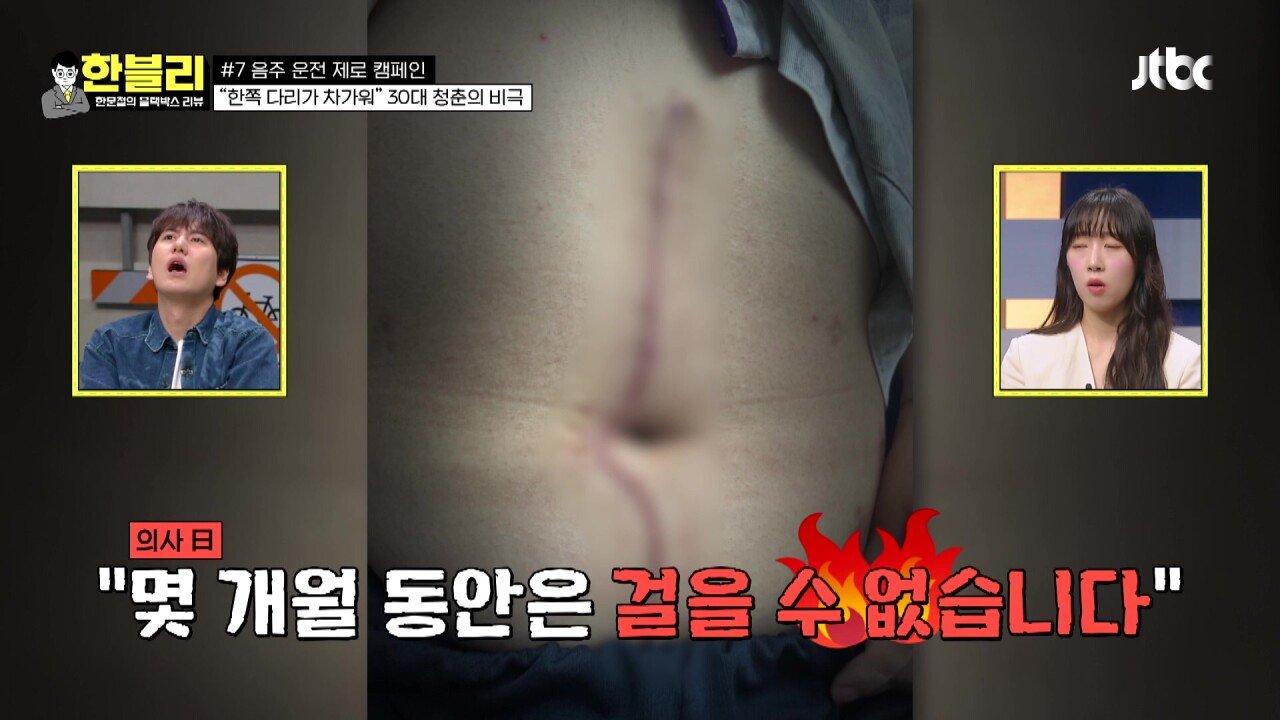 한블리 1.mp4_20230907_222239.616.jpg 방금전 한문철블박리뷰에서다룬 30대의 청춘을 앗아간 음주운전 역주행차량