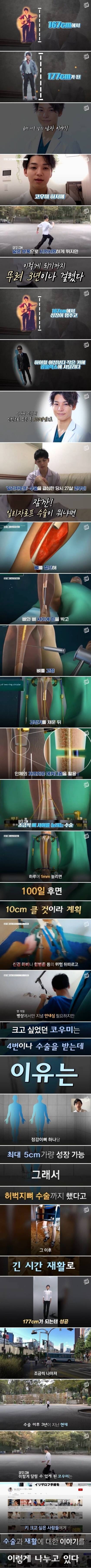 167cm에서 177cm로 키를 늘린 일본 의사 | 인스티즈