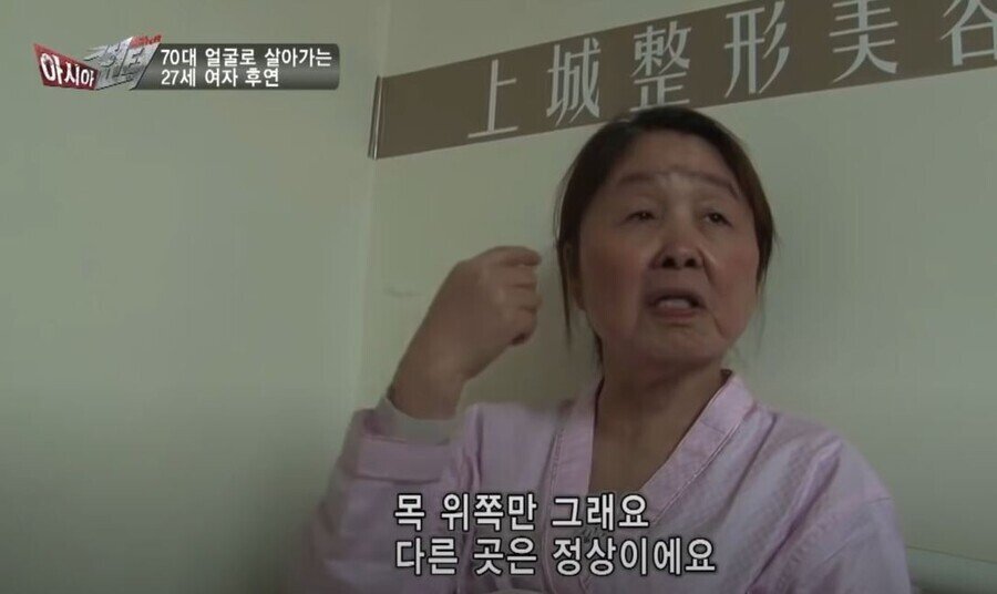 gifsf.com_003.jpg 실제 나이는 20대인데 70대 얼굴로 살아가는 여자.jpg