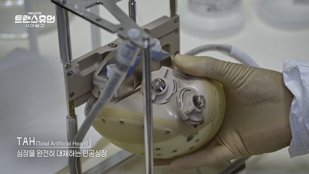 이슈 장애 자체를 삭제하는 미래 기술.jpg - 스퀘어.유머.사건사고 : 8c420acd85d15c819c2f35569af58289.jpg