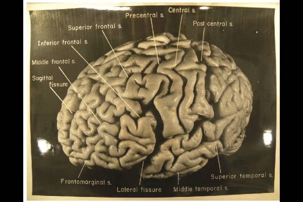 6.jpg 미국 박물관에 전시된 아인슈타인의 뇌