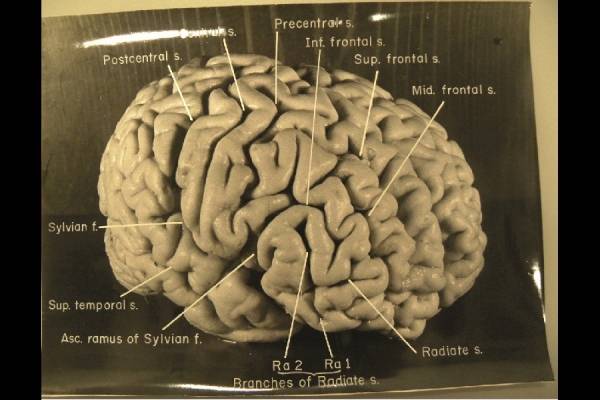 7.jpg 미국 박물관에 전시된 아인슈타인의 뇌