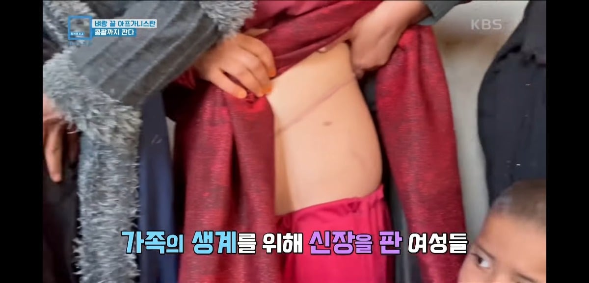 MGRUYB 탈레반 집권 이후 아동매매와 장기매매가 엄청 늘어버렸다는 아프가니스탄 상황...jpg