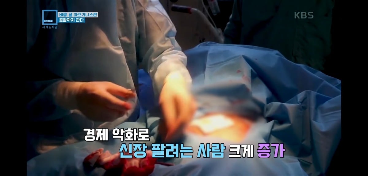HbYTEk 탈레반 집권 이후 아동매매와 장기매매가 엄청 늘어버렸다는 아프가니스탄 상황...jpg