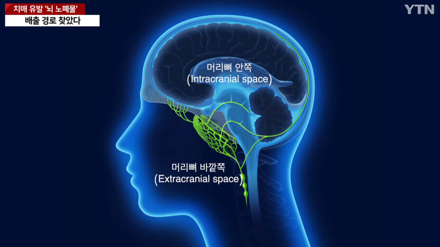 image.png 국내에서 세계최초로 "치매 유발 뇌 노폐물 배출 경로" 찾았다