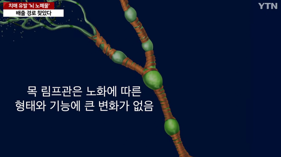 image.png 국내에서 세계최초로 "치매 유발 뇌 노폐물 배출 경로" 찾았다