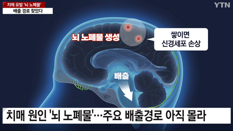 image.png 국내에서 세계최초로 "치매 유발 뇌 노폐물 배출 경로" 찾았다