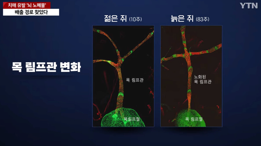 image.png 국내에서 세계최초로 "치매 유발 뇌 노폐물 배출 경로" 찾았다
