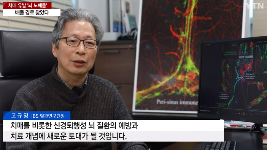 image.png 국내에서 세계최초로 "치매 유발 뇌 노폐물 배출 경로" 찾았다