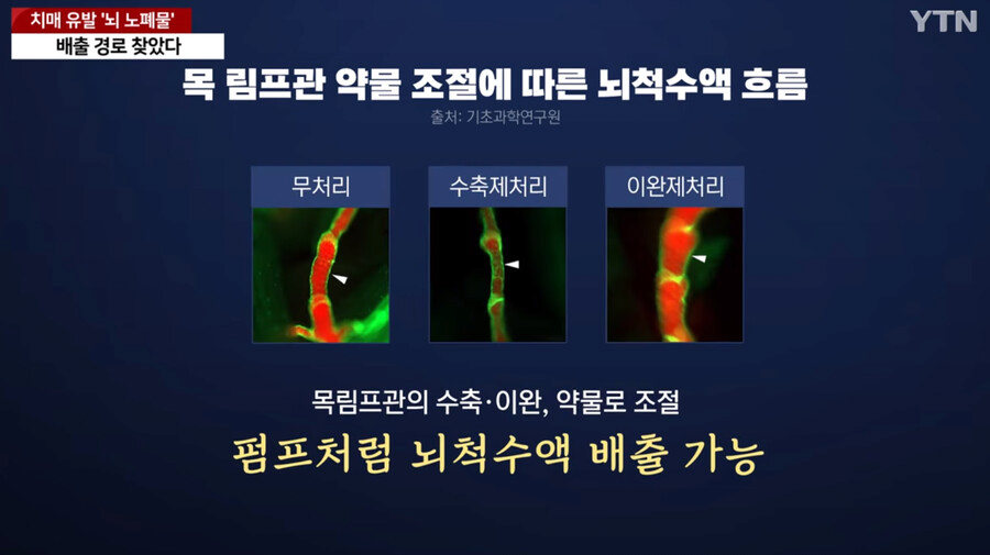 image.png 국내에서 세계최초로 "치매 유발 뇌 노폐물 배출 경로" 찾았다