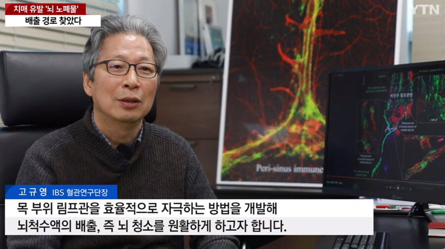 image.png 국내에서 세계최초로 "치매 유발 뇌 노폐물 배출 경로" 찾았다