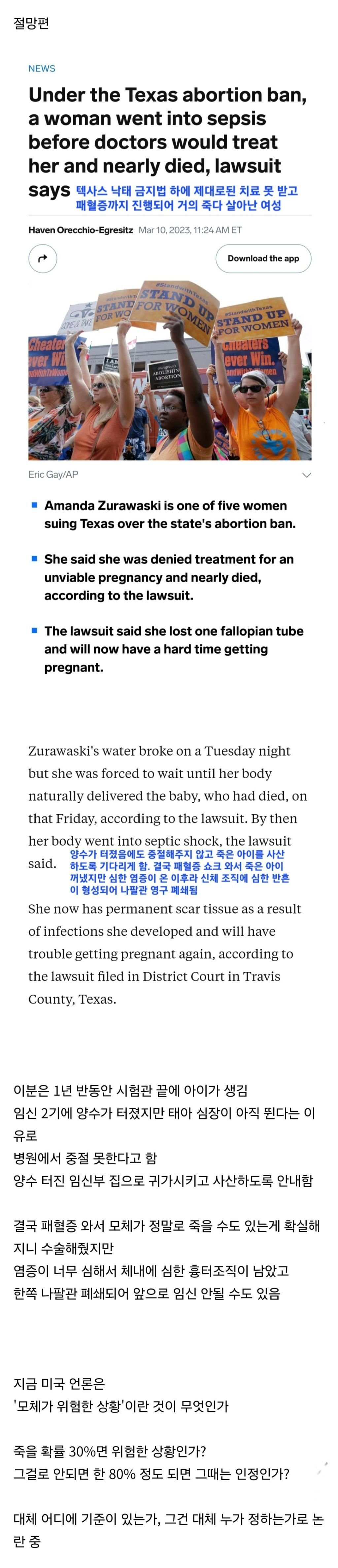 image.png 현재 미국에서 모르는 사람이 없는 수준인 임신부 [사진주의]