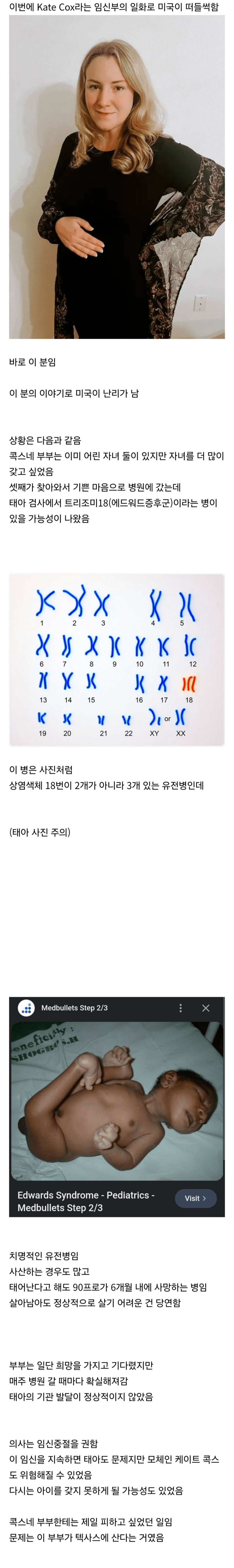 image.png 현재 미국에서 모르는 사람이 없는 수준인 임신부 [사진주의]