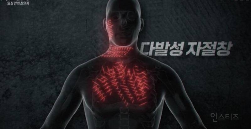 정유정이 역대급 개또라이인 이유 | 인스티즈