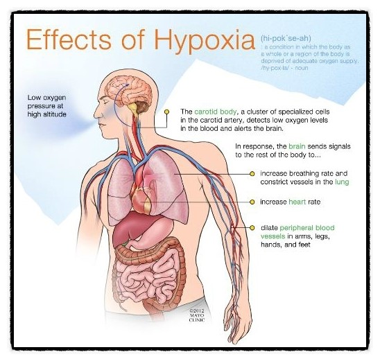 hypo.jpeg