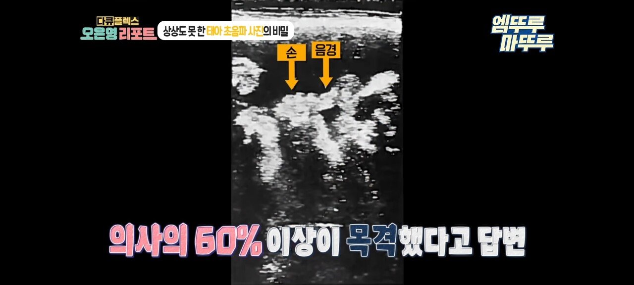신기한 태아 발기 태아도 발기를 하는구나