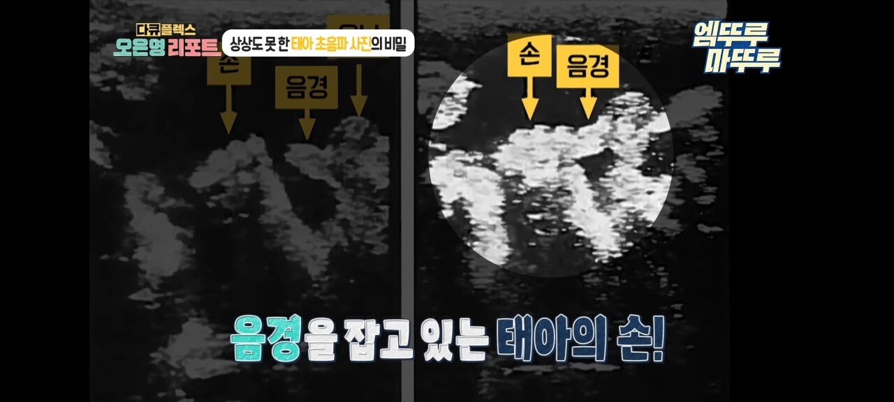 신기한 태아 발기 태아도 발기를 하는구나