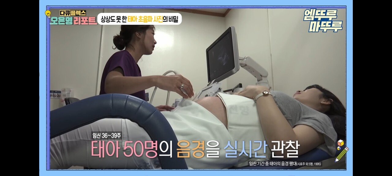 신기한 태아 발기 태아도 발기를 하는구나