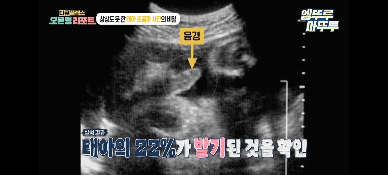 신기한 태아 발기 태아도 발기를 하는구나