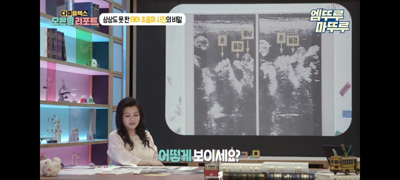 신기한 태아 발기 태아도 발기를 하는구나