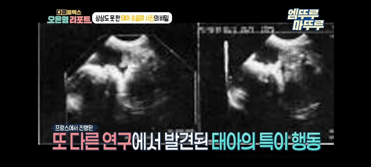 신기한 태아 발기 태아도 발기를 하는구나