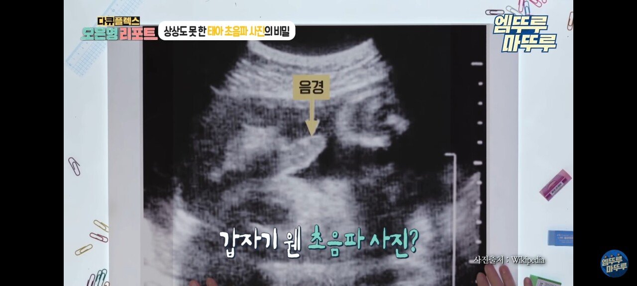 신기한 태아 발기 태아도 발기를 하는구나