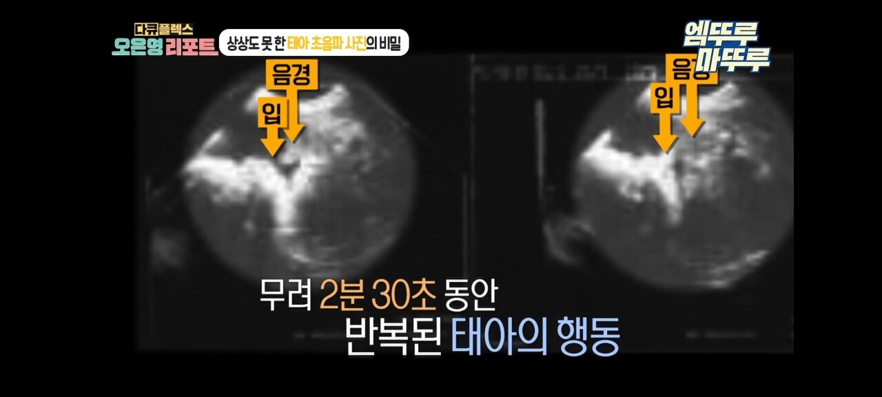 신기한 태아 발기 태아도 발기를 하는구나