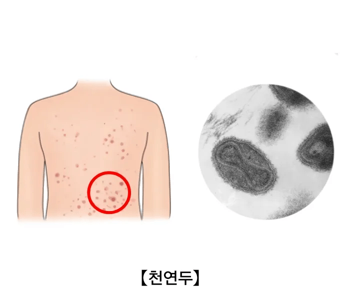 image.png 생물테러로 이용될 가능성이 매우 높은 병원체 모음