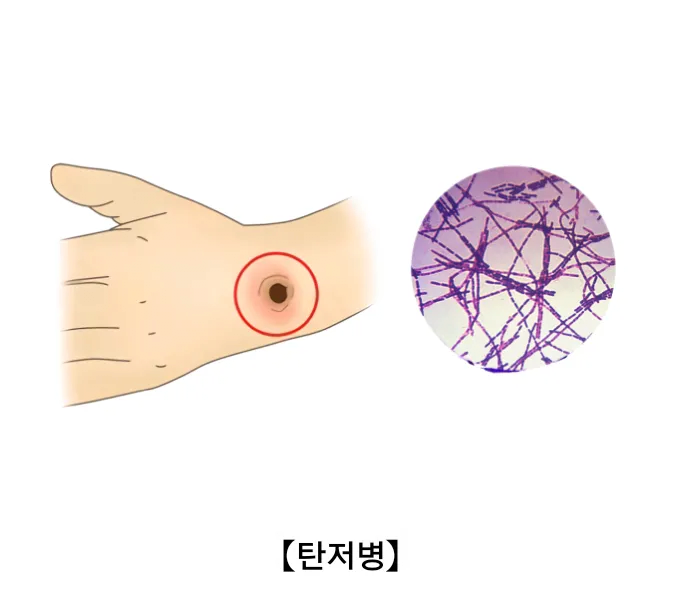 image.png 생물테러로 이용될 가능성이 매우 높은 병원체 모음