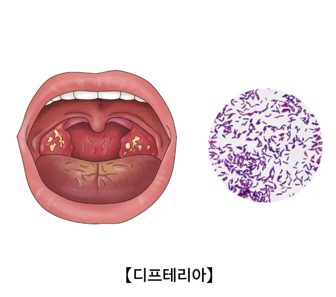 image.png 생물테러로 이용될 가능성이 매우 높은 병원체 모음