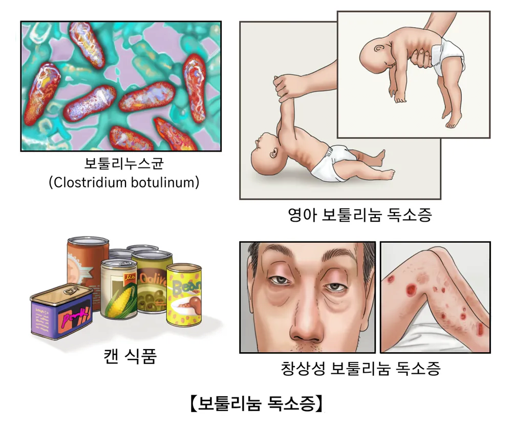 image.png 생물테러로 이용될 가능성이 매우 높은 병원체 모음