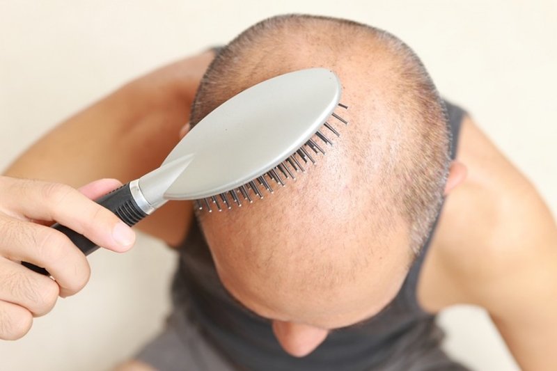 bigstock-brushing-thin-hair-76678505-840x560.jpg