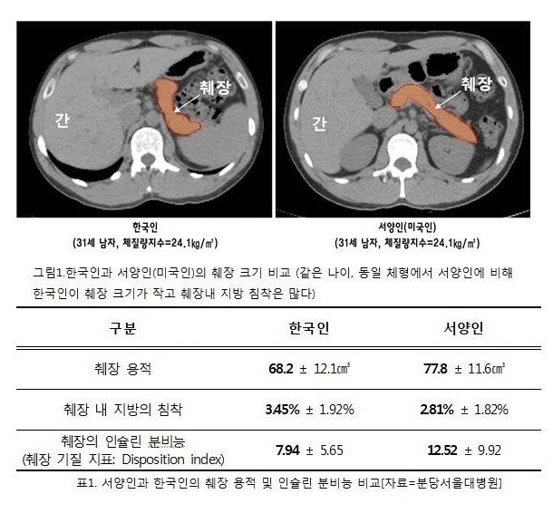 1000048885.png 다시 써보는 췌장 비교