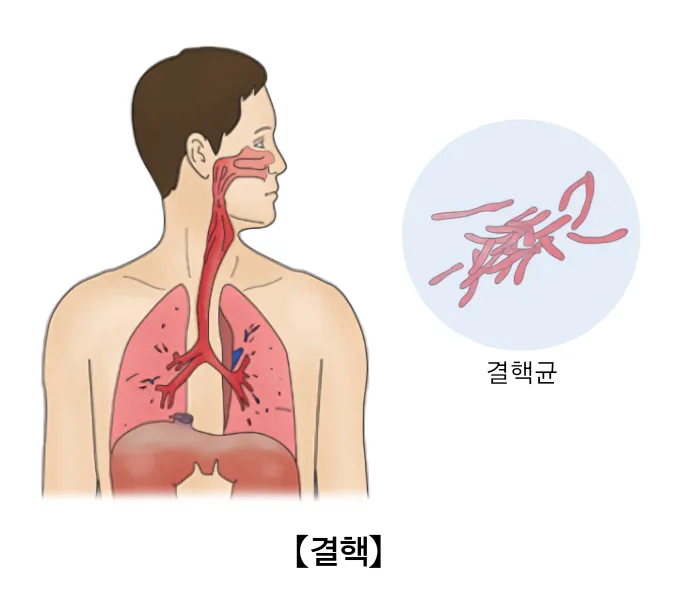 image.png 아프리카를 위협하는 3대 감염병