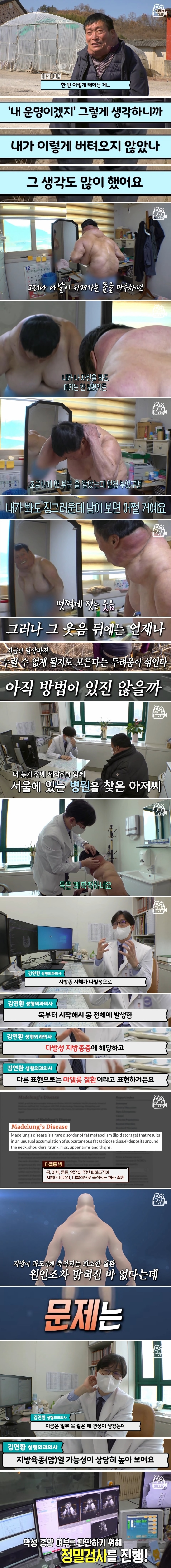 29년째, 원인 모를 이유로 부풀어 오른 몸 (5).jpg