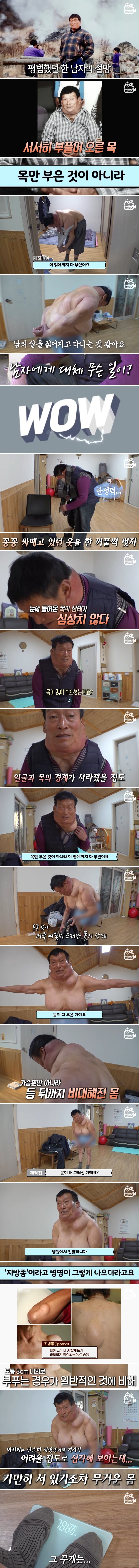 29년째, 원인 모를 이유로 부풀어 오른 몸 (1).jpg