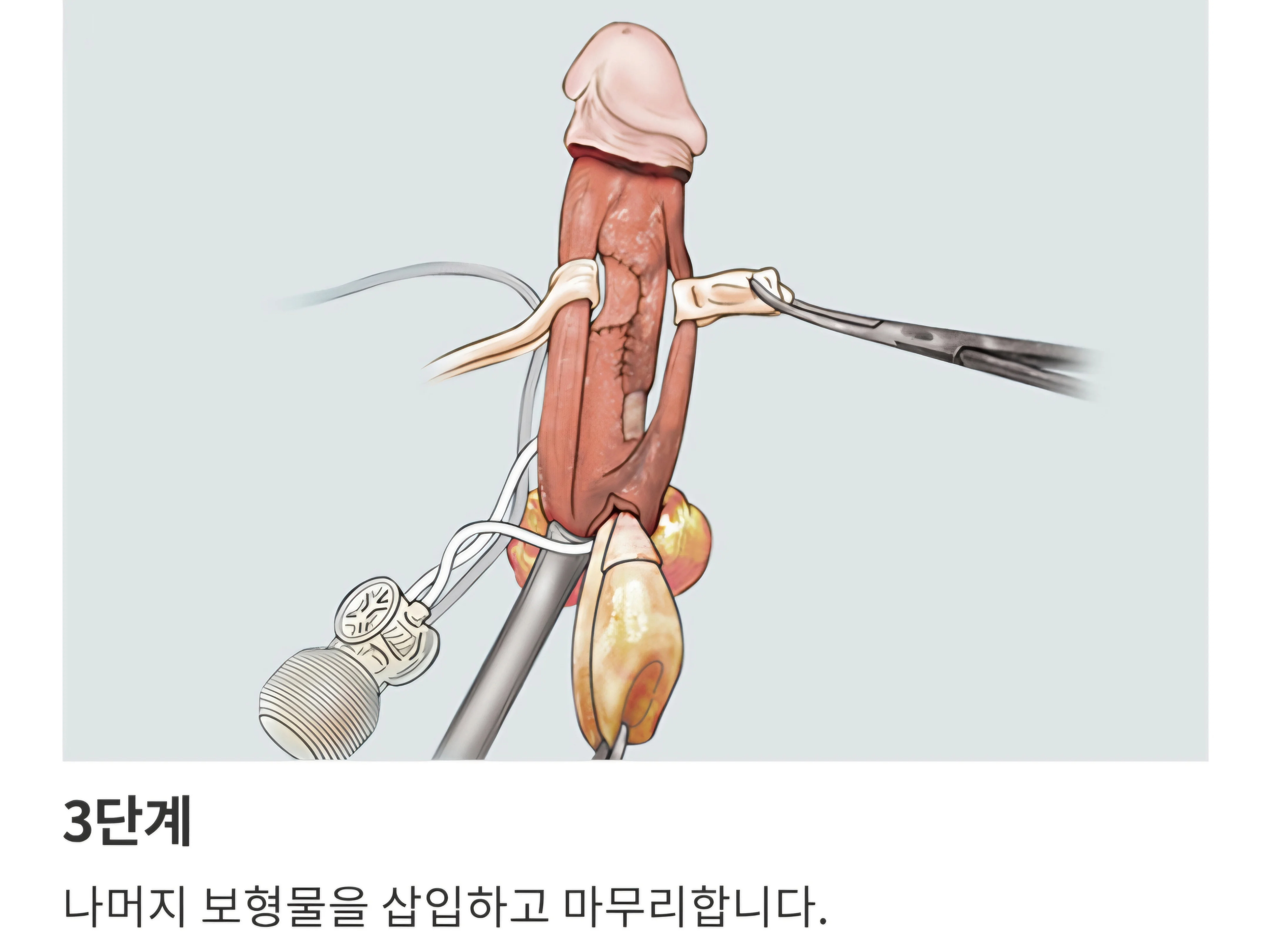 P_008.jpg