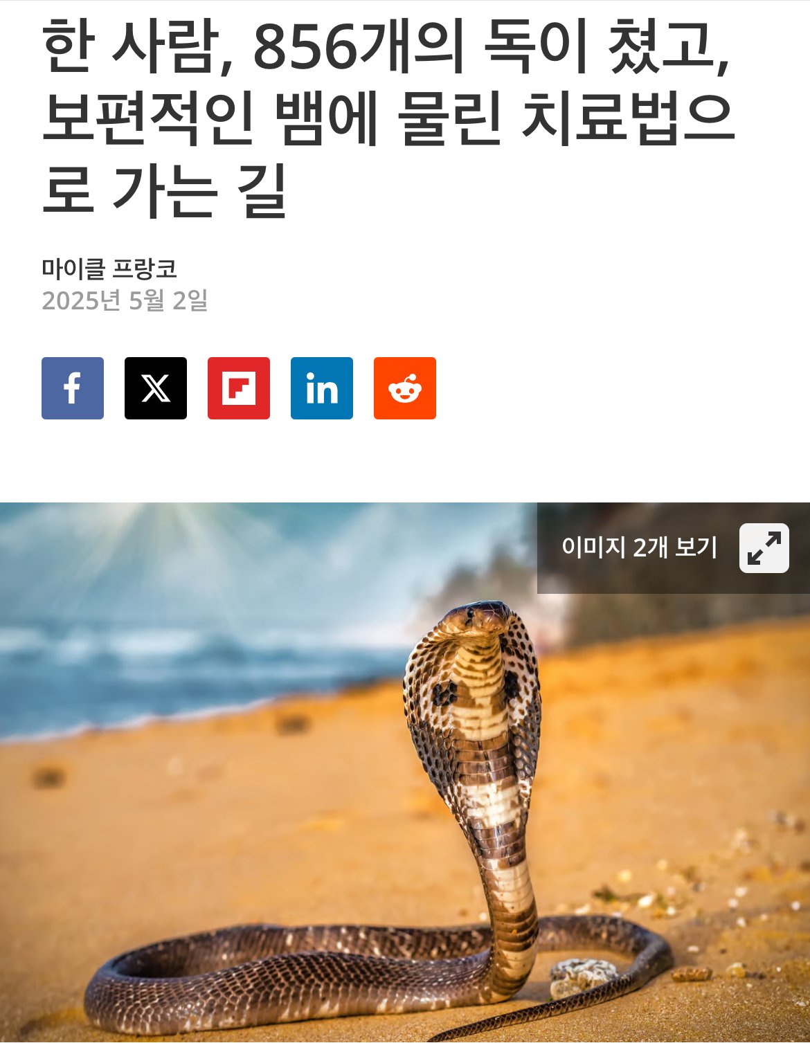 IMG_5489.jpeg 현재 18년동안 독사한테 856번 물린 사람 근황 ㅎㄷㄷㄷㄷ
